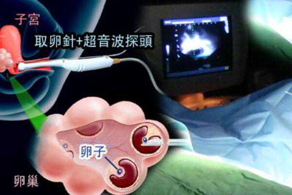 青岛朝阳医院取卵后多久短信通知胚胎停止培育？